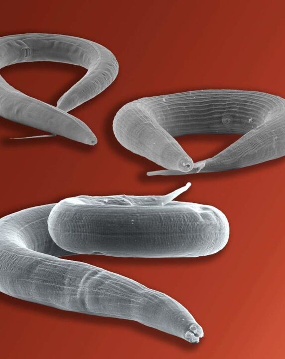 Lombriz intestinal